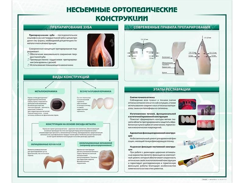 Стенд "Несъёмные ортопедические конструкции"
